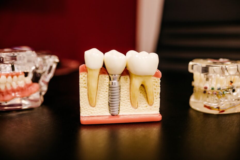 malatya implant diş